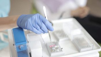 Why the Shift to Same-Day Teeth Is Changing How Patients Weigh Dental Implant Treatment Options